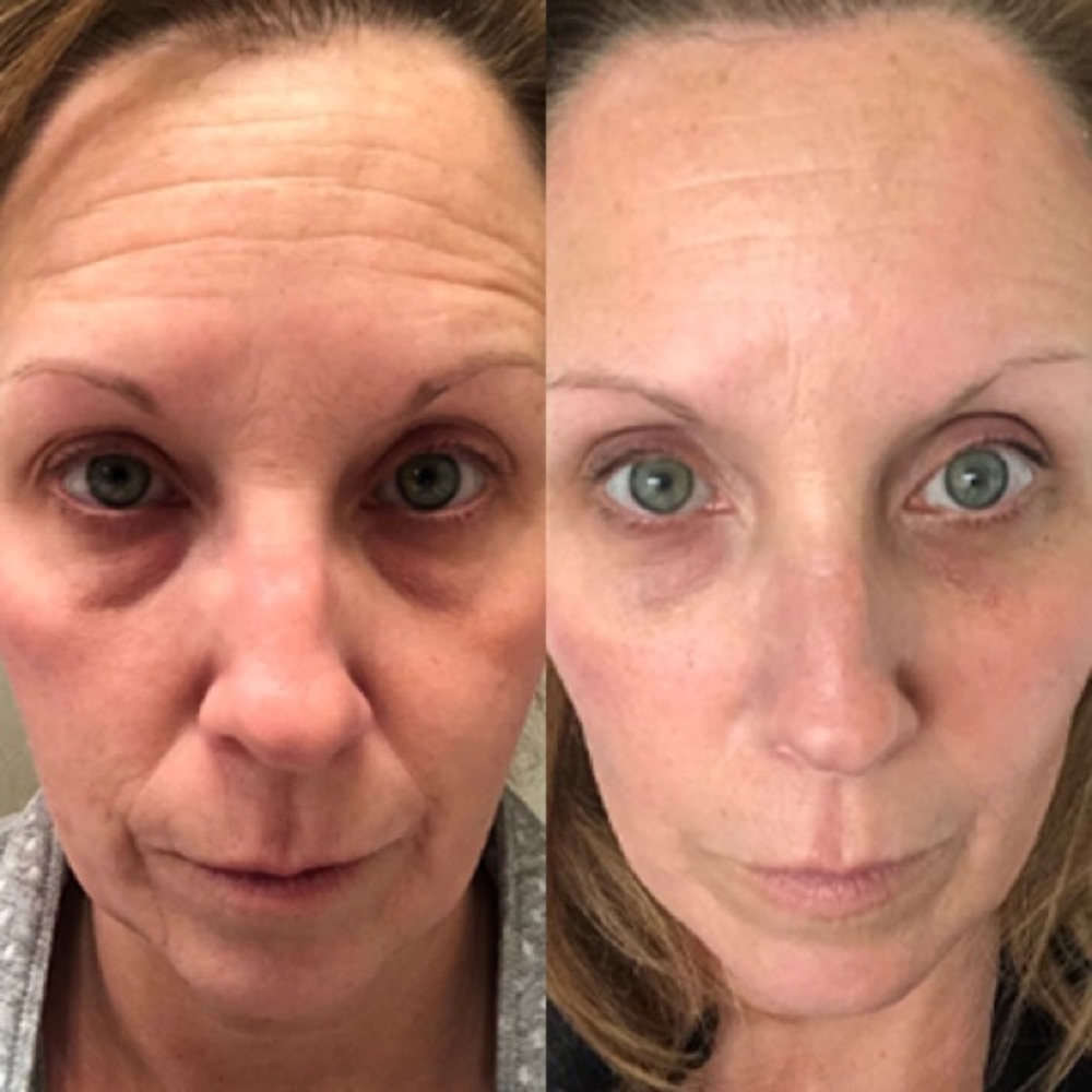 COPY - Collagen Elixir - Picture 6 of 11